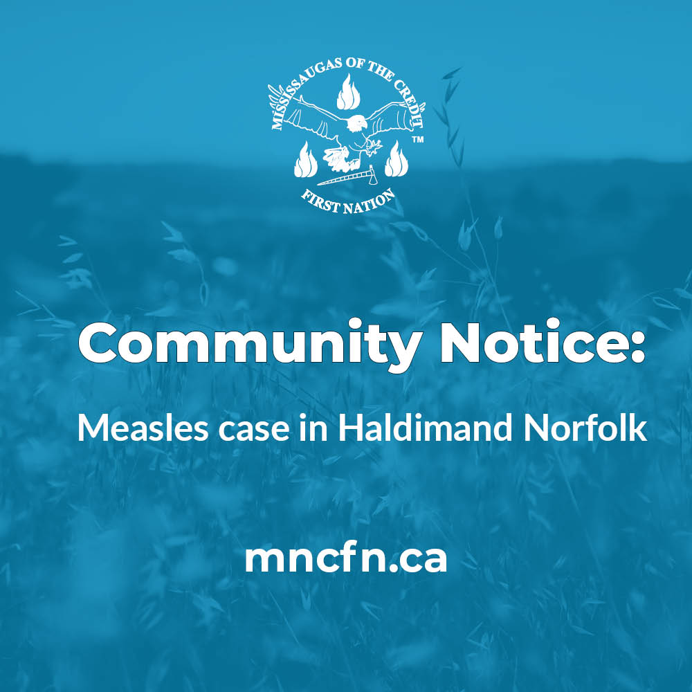 Notice of Measles Case in Norfolk